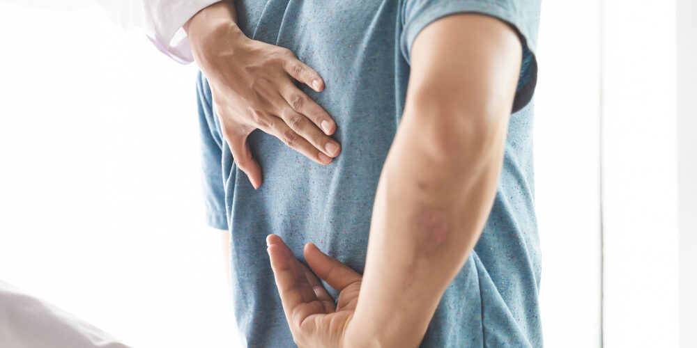 Prevención en Fisioterapia